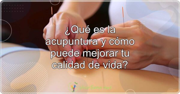 ¿Qué es la acupuntura y cómo puede mejorar tu calidad de vida?