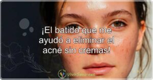 ¡El batido que me ayudó a eliminar el acné sin cremas!