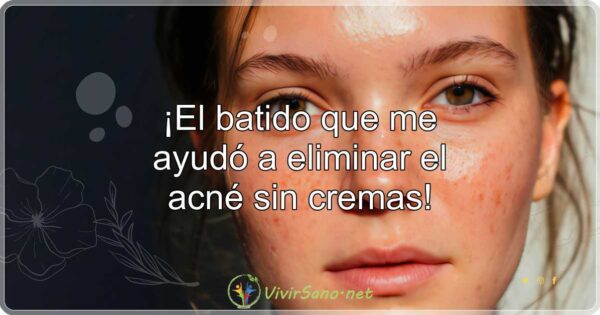 ¡El batido que me ayudó a eliminar el acné sin cremas!